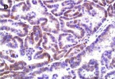 Immunohistochemistry: EHD2 Antibody [NBP2-33283]