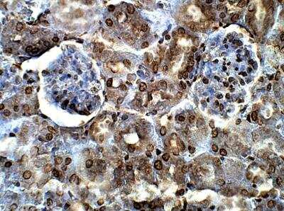 Immunohistochemistry-Paraffin: EHD2 Antibody [NBP3-12299]