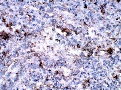 Immunohistochemistry-Paraffin: EHD2 Antibody [NBP3-12299]
