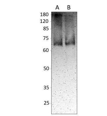 Immunohistochemistry-Paraffin: EHD2 Antibody [NBP3-12299]