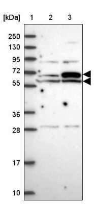 Western Blot: EHD2 Antibody [NBP2-33283]