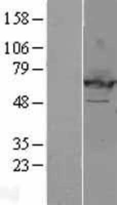 Western Blot: EHD2 Overexpression Lysate [NBL1-10158]