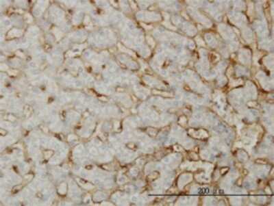 Immunohistochemistry-Paraffin: EHD3 Antibody (4B7) [H00030845-M01]