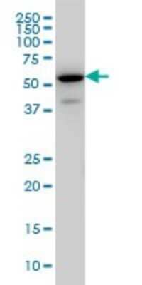 Western Blot: EHD3 Antibody (4B7) [H00030845-M01]