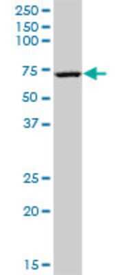 Western Blot: EHD3 Antibody (4B7) [H00030845-M01]