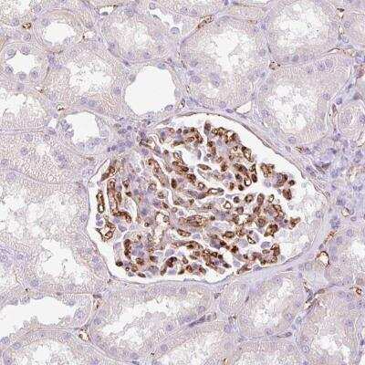 Immunohistochemistry-Paraffin: EHD3 Antibody [NBP2-31894]