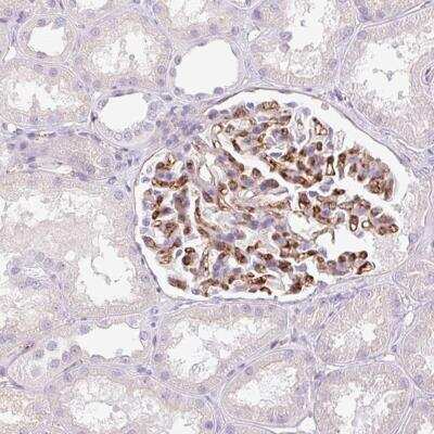 Immunohistochemistry-Paraffin: EHD3 Antibody [NBP2-31896]