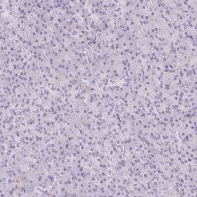 Immunohistochemistry-Paraffin: EHD3 Antibody [NBP2-31896]