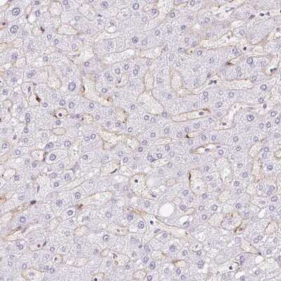 Immunohistochemistry-Paraffin: EHD3 Antibody [NBP2-31896]