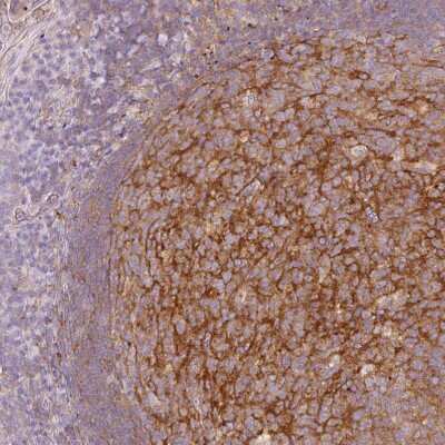 Immunohistochemistry-Paraffin: EHD3 Antibody [NBP2-31896]