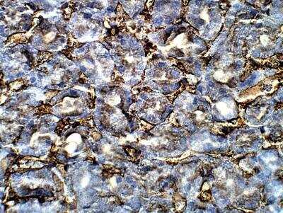 Immunohistochemistry-Paraffin: EHD3 Antibody [NBP3-12300]