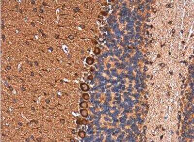 Immunohistochemistry-Paraffin: EHD4 Antibody [NBP2-16287]