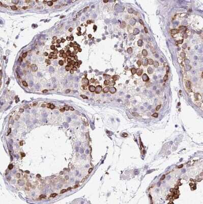 Immunohistochemistry-Paraffin: EHD4 Antibody [NBP2-33665]