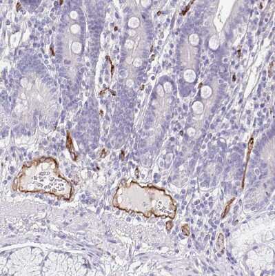 Immunohistochemistry-Paraffin: EHD4 Antibody [NBP2-33665]