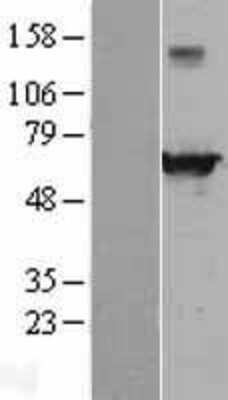 Western Blot: EHD4 Overexpression Lysate [NBL1-10160]