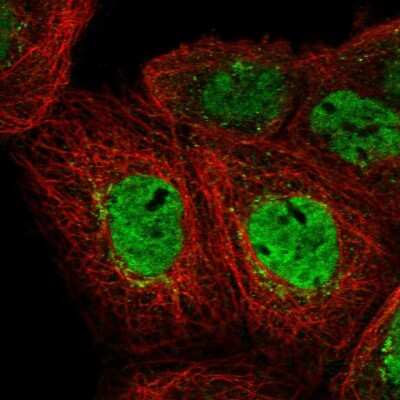 Immunocytochemistry/ Immunofluorescence: EHF Antibody [NBP2-56705]