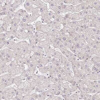 Immunohistochemistry-Paraffin: EHF Antibody [NBP2-38896]