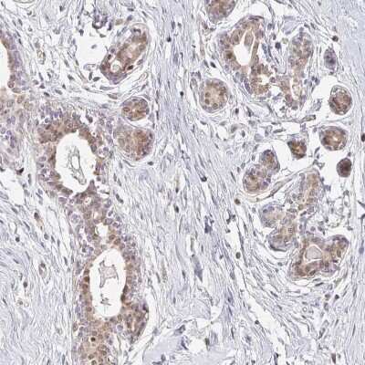 Immunohistochemistry-Paraffin: EHF Antibody [NBP2-38896]