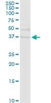 Western Blot: EHF Antibody [H00026298-D01P]