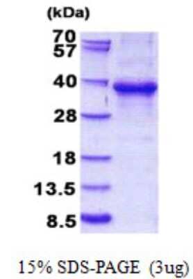 SDS-PAGE: Recombinant Human EHF His Protein [NBP2-23029]