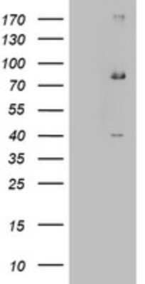 Western Blot: EHHADH Antibody (OTI2C4) [NBP2-46487]