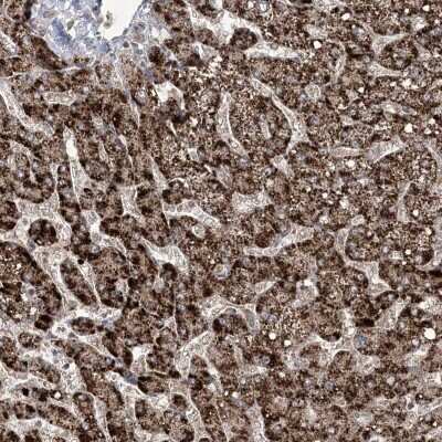 Immunohistochemistry-Paraffin: EHHADH Antibody [NBP1-84915]