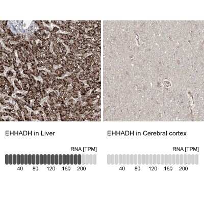 Immunohistochemistry-Paraffin: EHHADH Antibody [NBP1-84915]