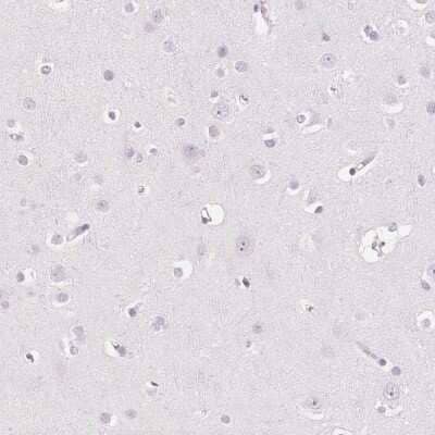 Immunohistochemistry-Paraffin: EHHADH Antibody [NBP2-48754]