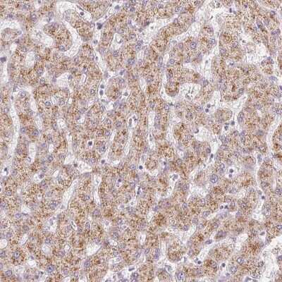 Immunohistochemistry-Paraffin: EHHADH Antibody [NBP2-48754]