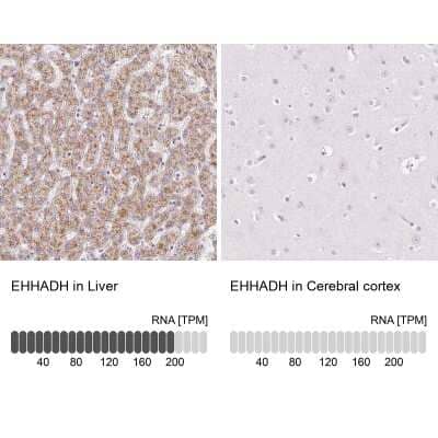 Immunohistochemistry-Paraffin: EHHADH Antibody [NBP2-48754]