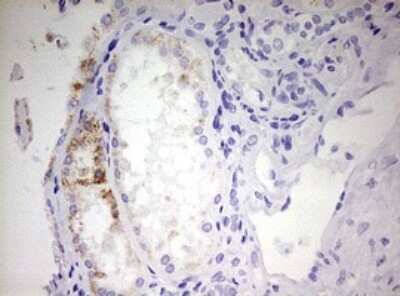 Immunohistochemistry: EHHADH Antibody (OTI2C4) - Azide and BSA Free [NBP2-70625]