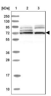 Western Blot: EHHADH Antibody [NBP1-84915]
