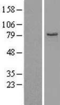 Western Blot: EHHADH Overexpression Lysate [NBL1-10162]