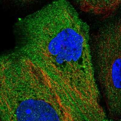 Immunocytochemistry/ Immunofluorescence: EHM2 Antibody [NBP1-83988]