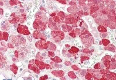 Immunohistochemistry-Paraffin: EHM2 Antibody [NBP1-00181]