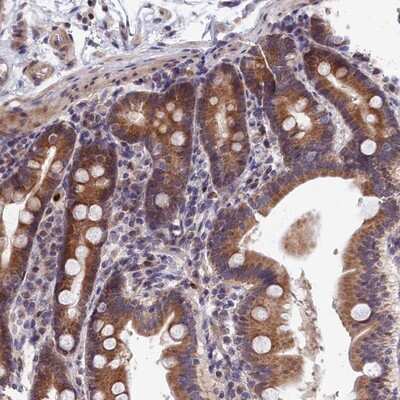 Immunohistochemistry-Paraffin: EHM2 Antibody [NBP1-83988]