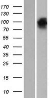 Western Blot: EHM2 Overexpression Lysate [NBP2-06716]