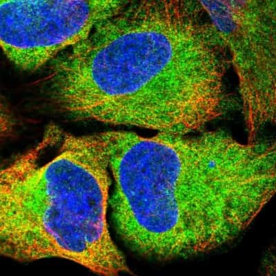 Immunocytochemistry/ Immunofluorescence: EI24 Antibody [NBP2-48993]