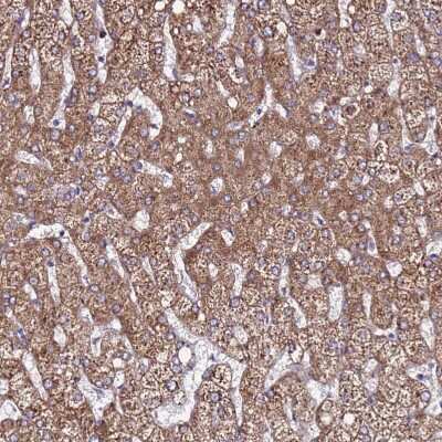 Immunohistochemistry-Paraffin: EI24 Antibody [NBP2-13949]