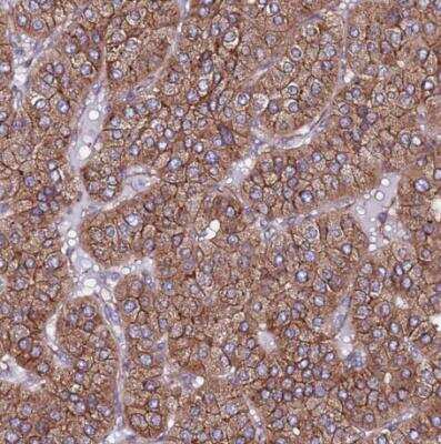 Immunohistochemistry-Paraffin: EI24 Antibody [NBP2-13949]
