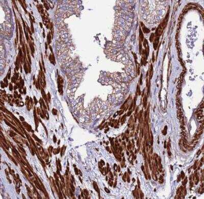 Immunohistochemistry-Paraffin: EI24 Antibody [NBP2-13949]