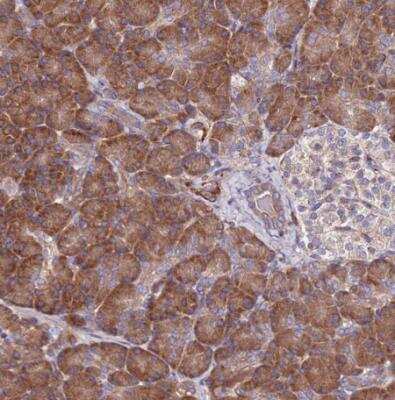 Immunohistochemistry-Paraffin: EI24 Antibody [NBP2-13949]