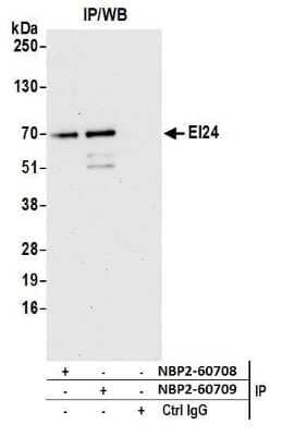 Immunoprecipitation: EI24 Antibody [NBP2-60708]