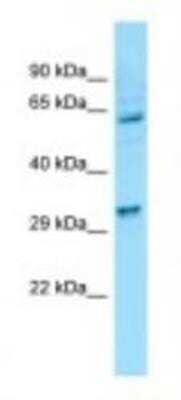 Western Blot: EI24 Antibody [NBP1-98605]