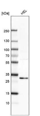 Western Blot: EI24 Antibody [NBP2-13949]