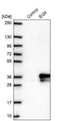 Western Blot: EI24 Antibody [NBP2-48993]