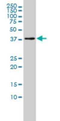 Western Blot: EI2BL Antibody (2D11-1G4) [H00084245-M01]