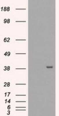 Western Blot: EI2BL Antibody (OTI9H7) [NBP1-47857]