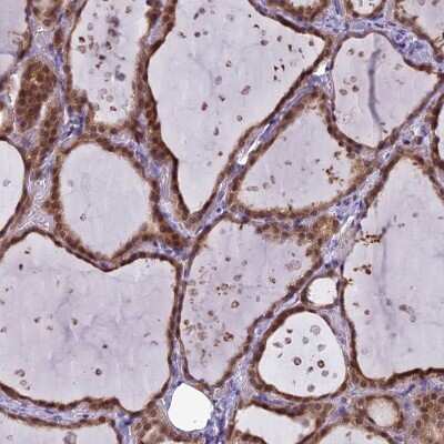 Immunohistochemistry: EI2BL Antibody [NBP2-47475]