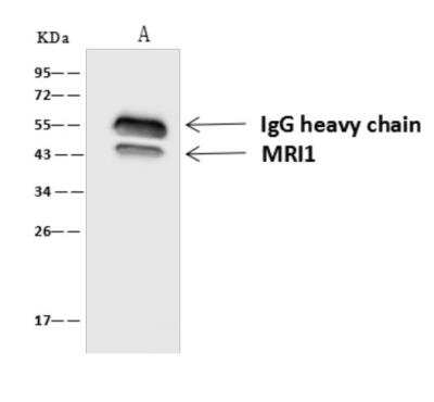 Immunoprecipitation: EI2BL Antibody [NBP3-06310]